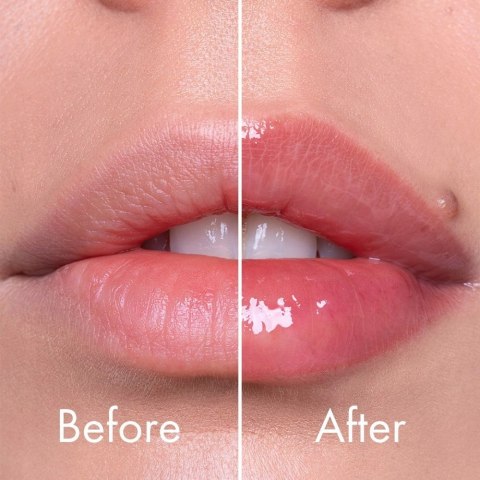 VT Cosmetics | Reedle Shot Lip Plumper Expert | Serum do Ust Powiększające Efekt Botoxu - 4,3g